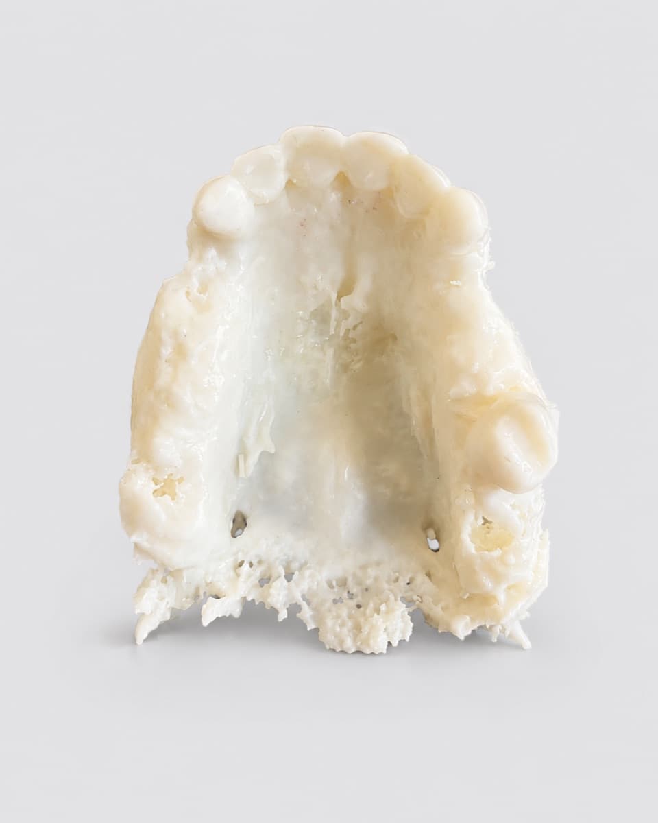 Vue occlusale